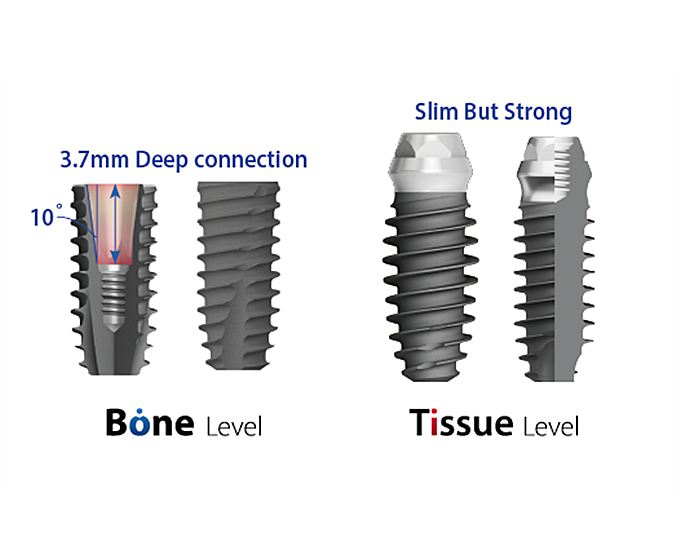 덴티움 ‘브라이트 임플란트’ 각광