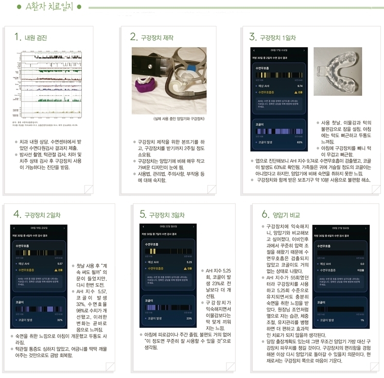 구강장치는 판테라 슬립으로 제작했고, 치료결과는 의료기기로 인증받은 수면진단 앱을 활용했다. 
