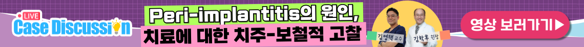 배너