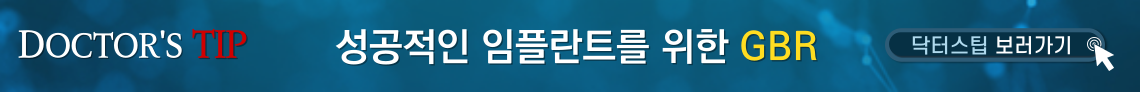 배너