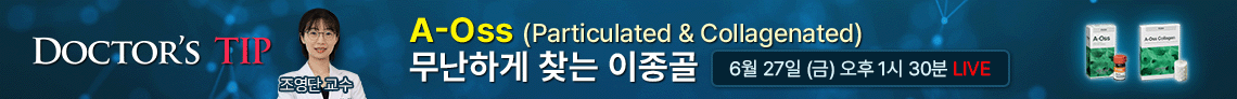 배너