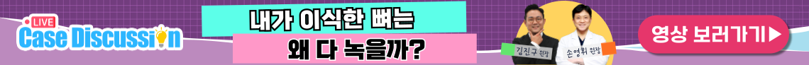 배너
