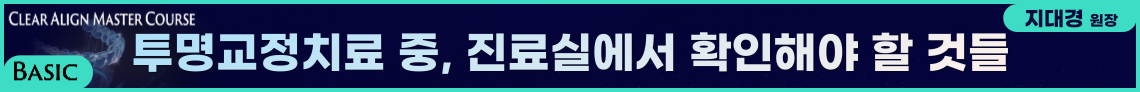 배너