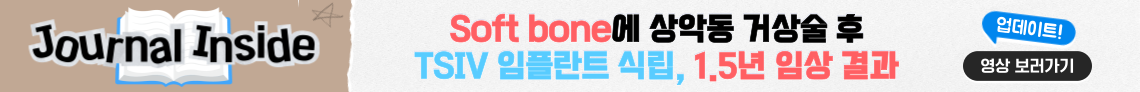 배너
