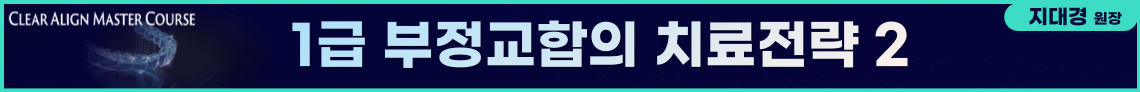 배너