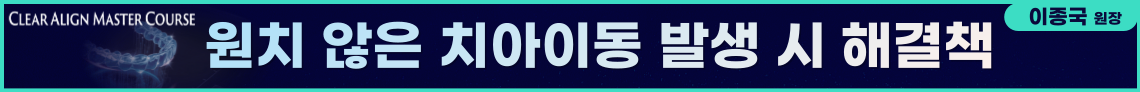 배너