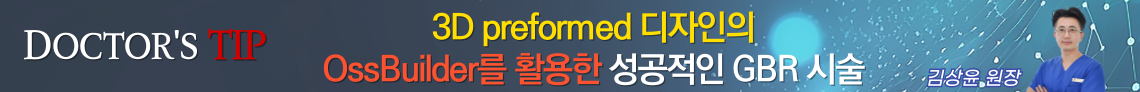 배너
