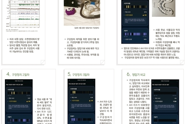 A환자 수면치료 일지, “구강장치 직접 사용해보니…”