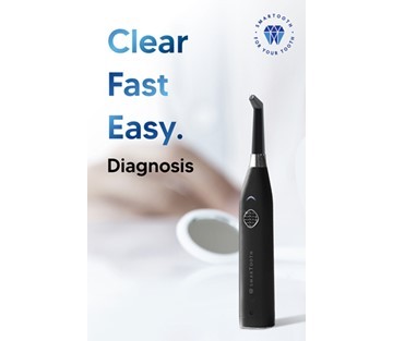 힐덴스, 똑똑한 충치진단기 ‘스마투스’ - 뉴스 썸네일 이미지